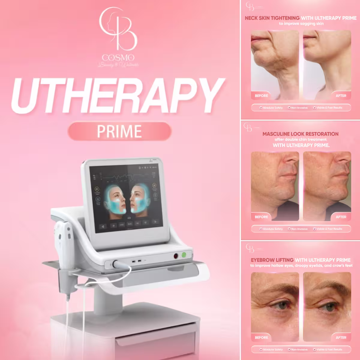 Bioidentical Hormone Therapy (BHRT)