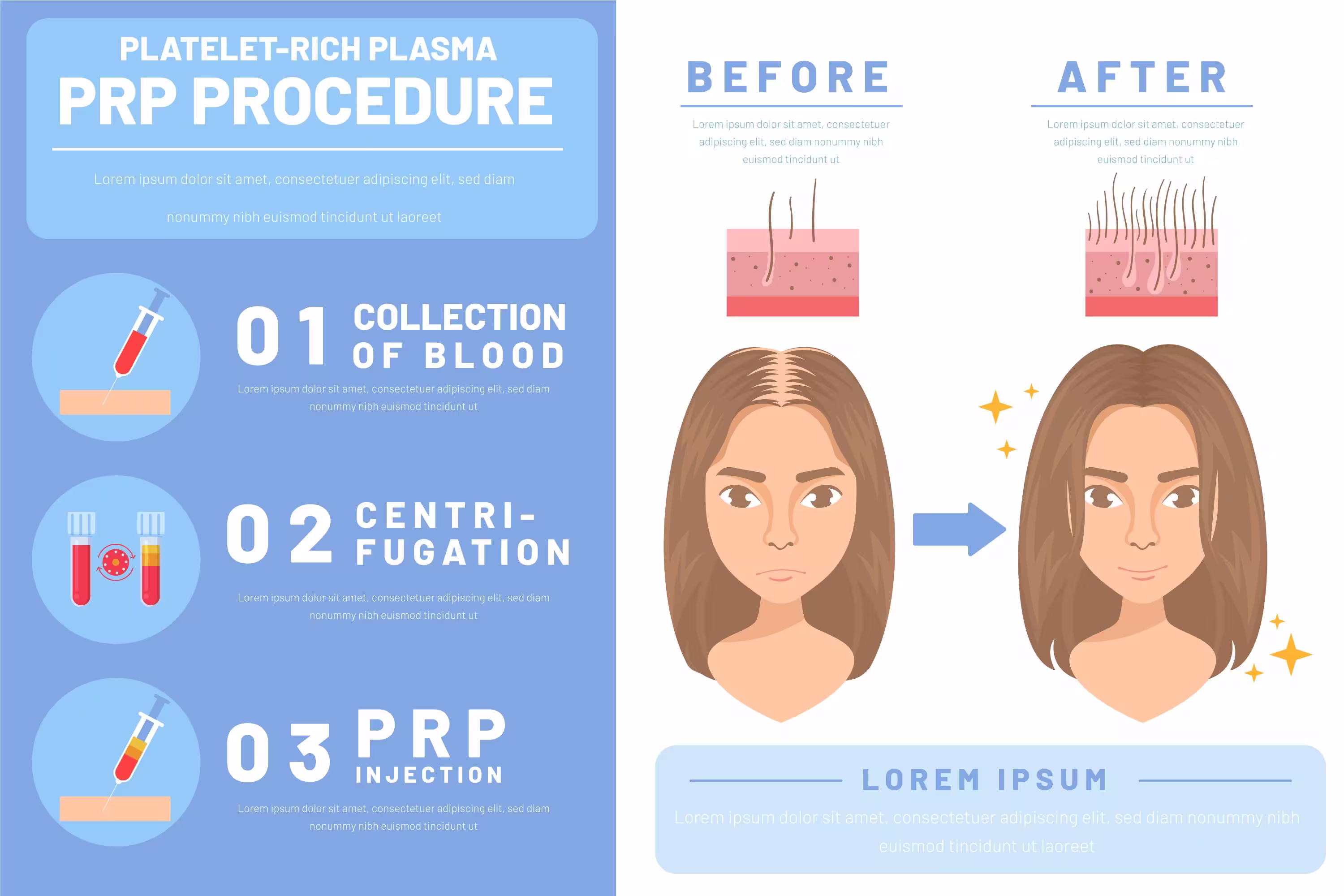 PRP / PRF Therapy 1